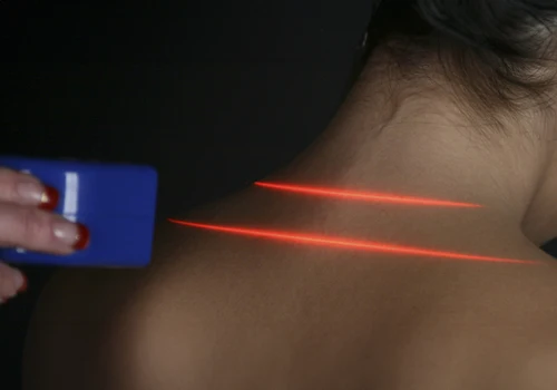 Chiropractic Bloomington MN Cold Laser Therapy